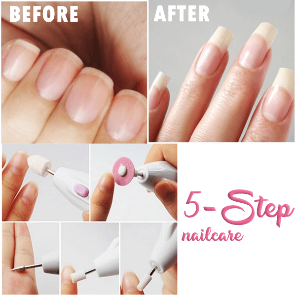 5 In 1 Perfect Nail Kit